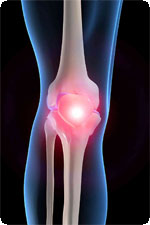Одной из основных причин болей в колене является когда-то полученная травма
